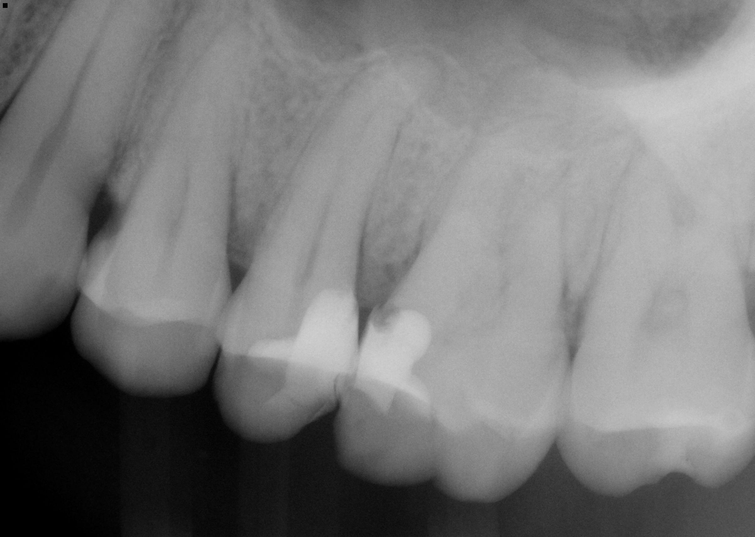 pre-op radiograph