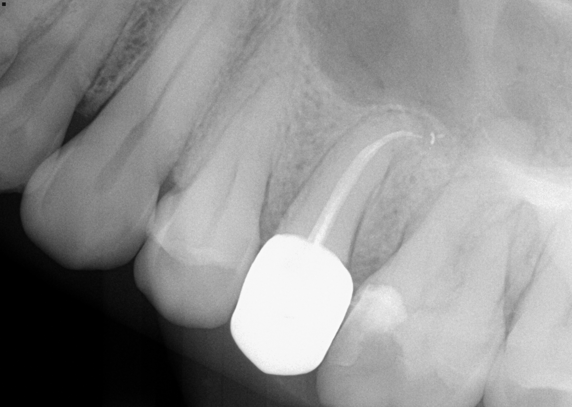 follow-up radiograph