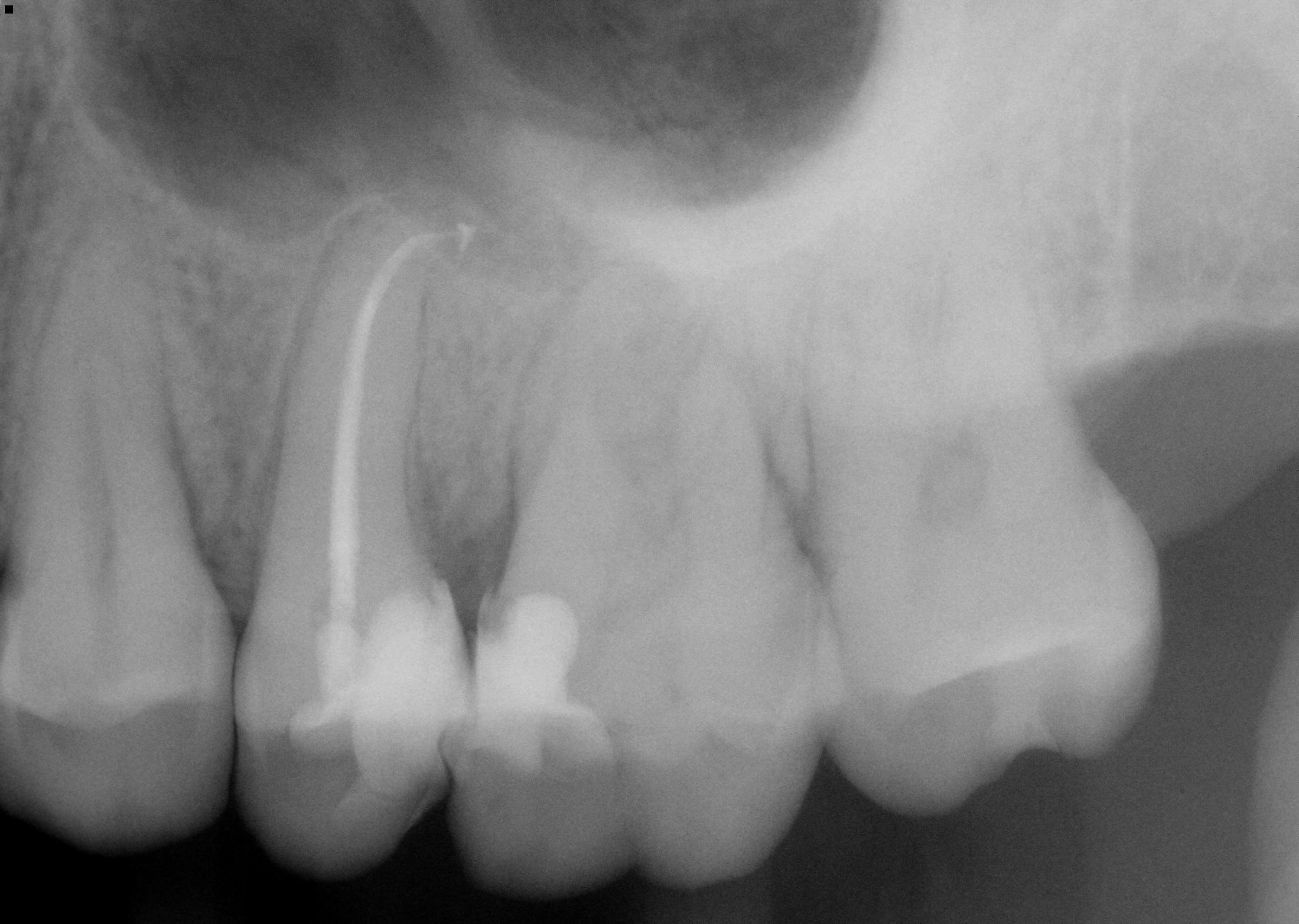 post-op radiograph