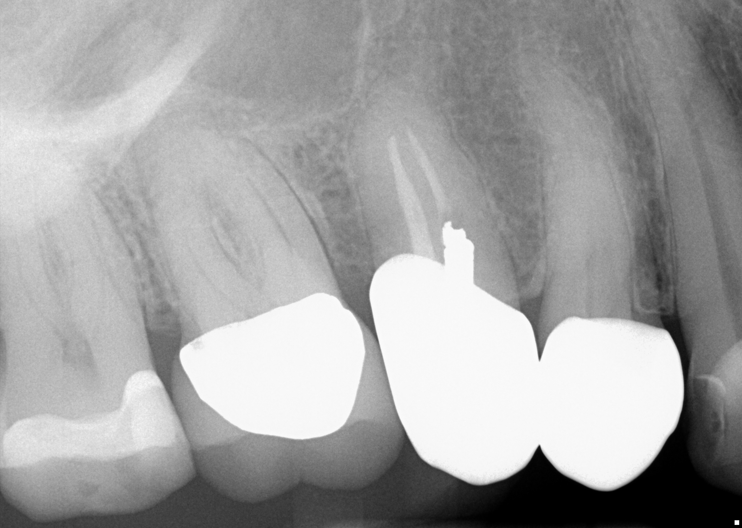 pre-op radiograph