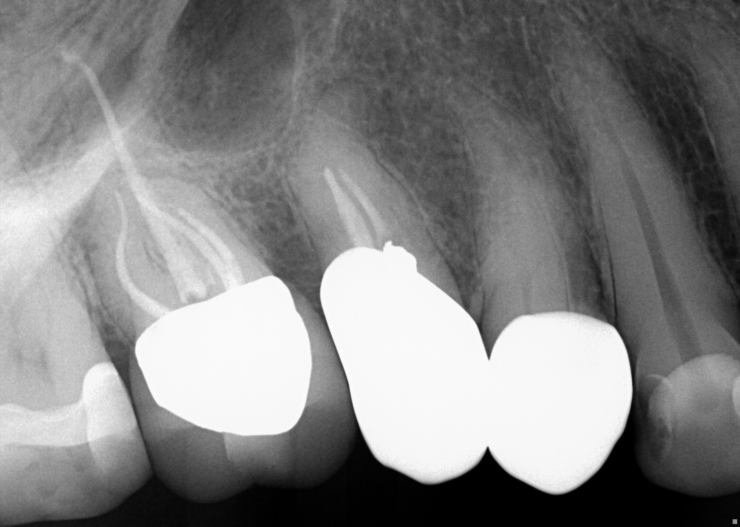post-op radiograph
