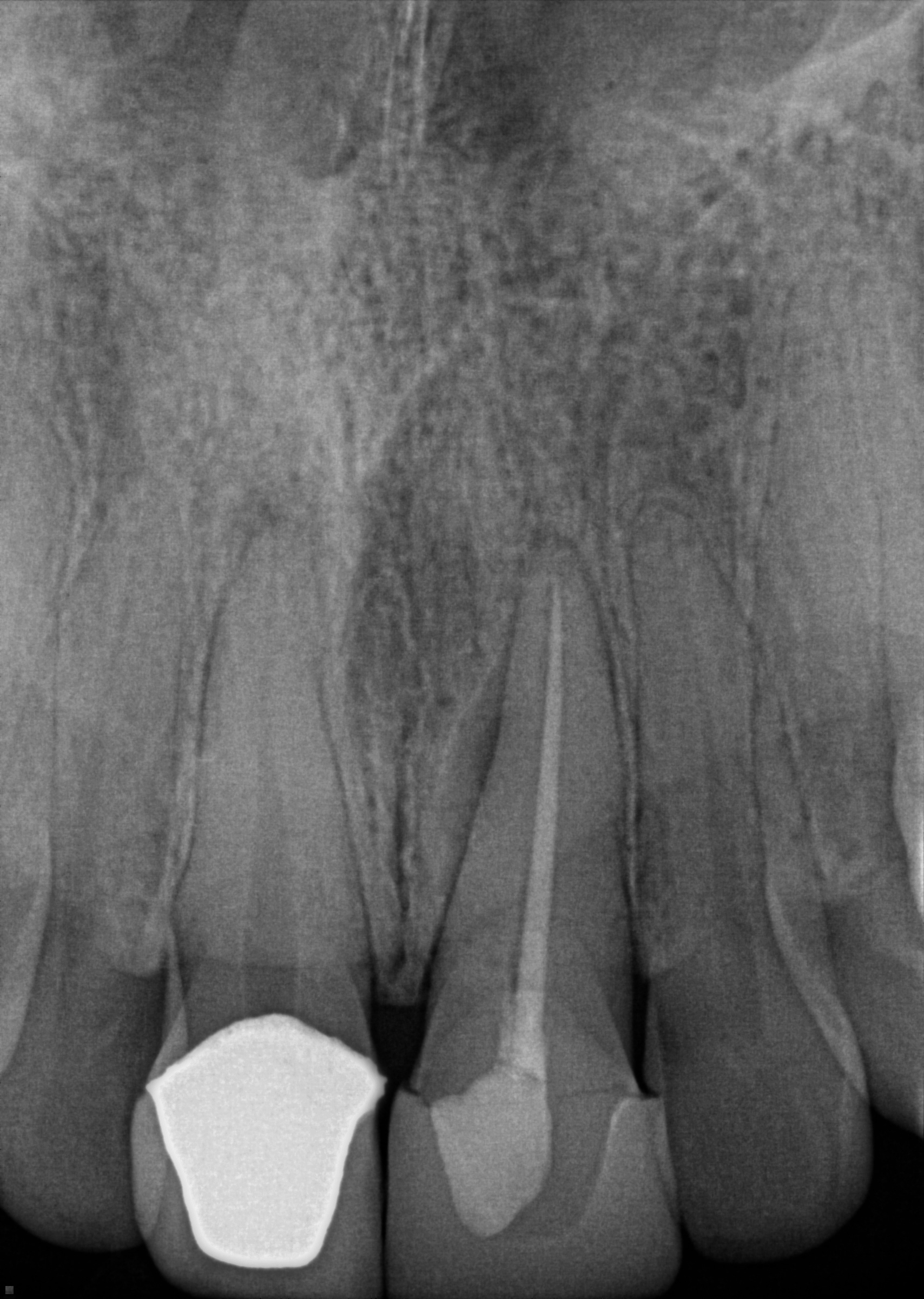 pre-op radiograph