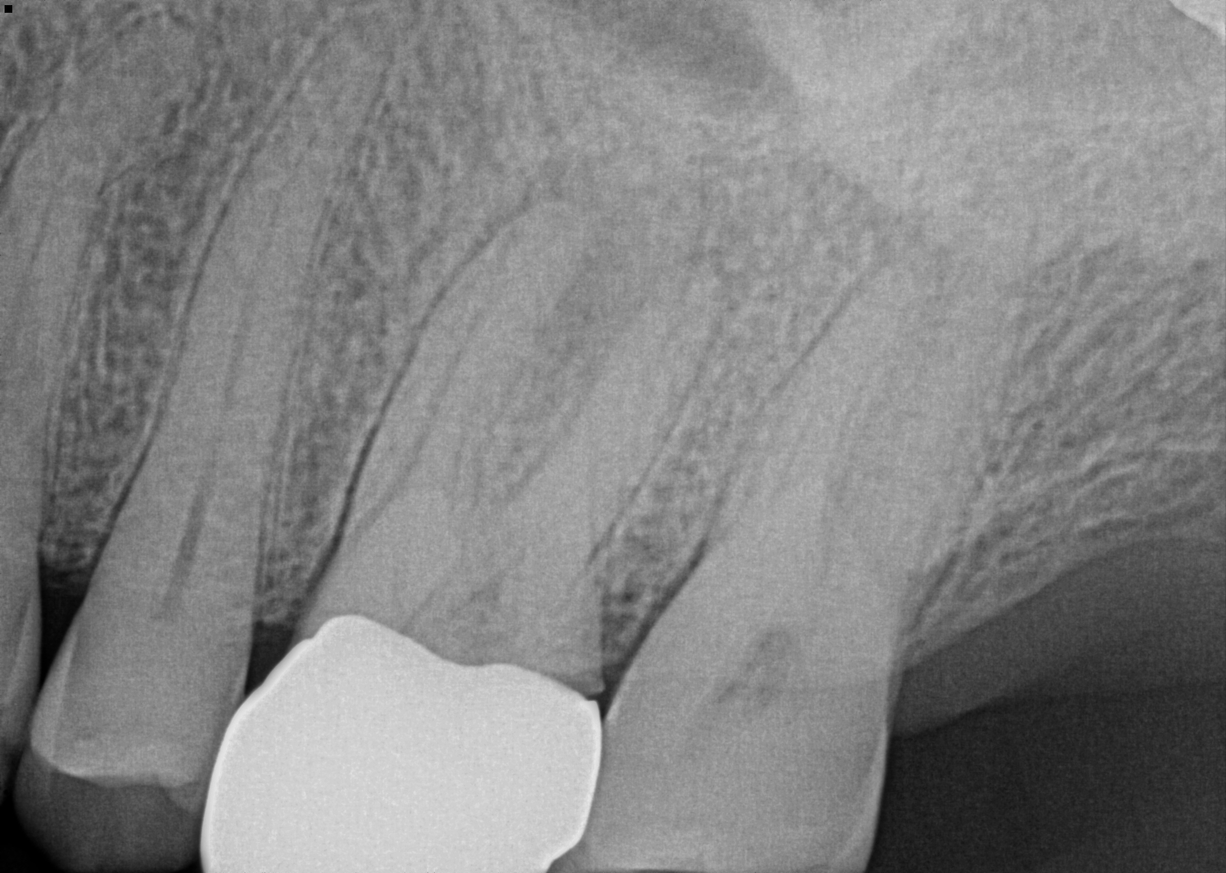 pre-op radiograph