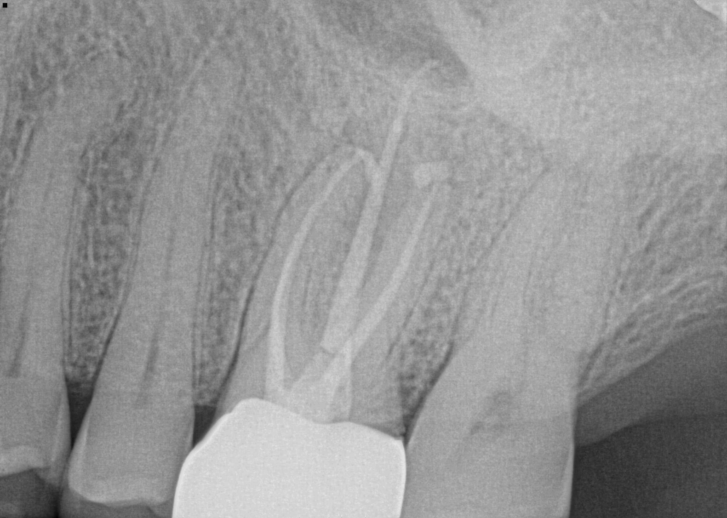post-op radiograph