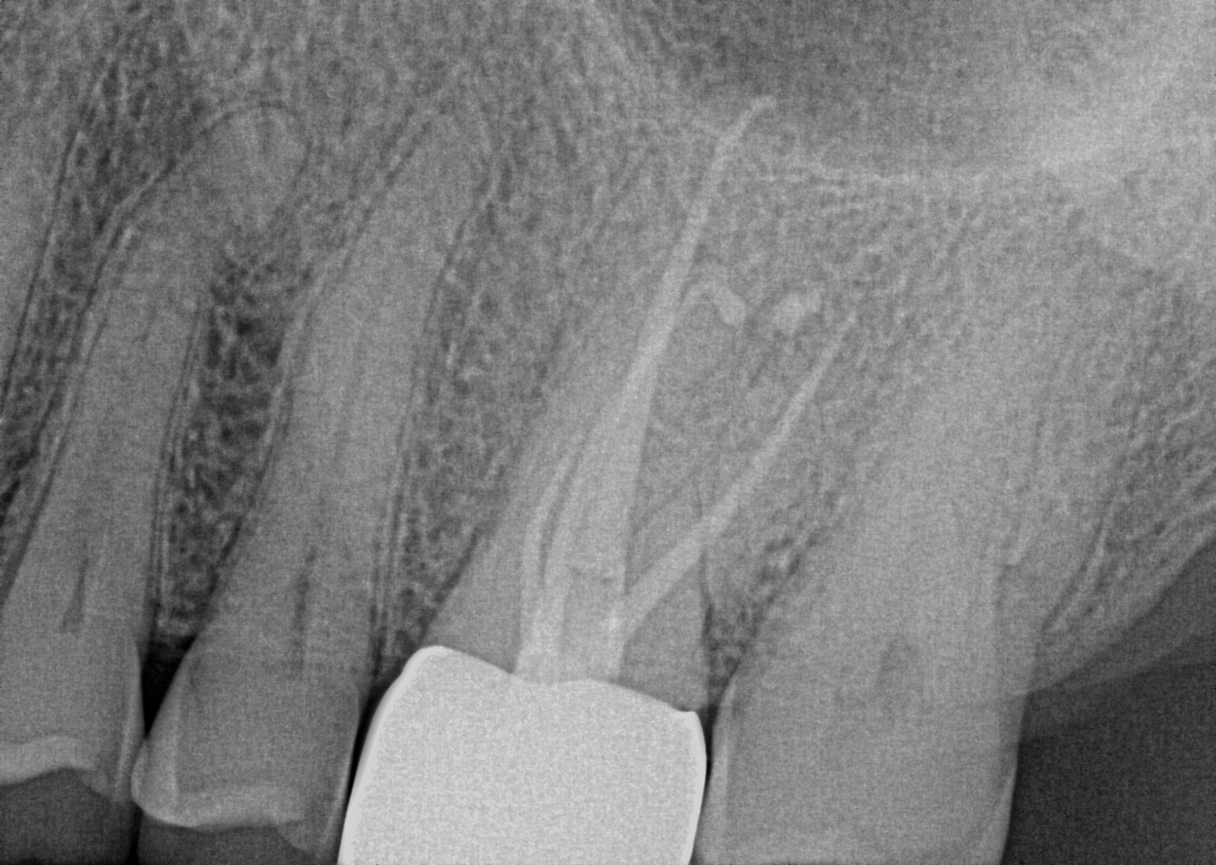 follow-up radiograph