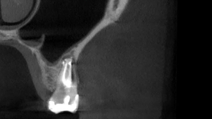 post-op scan