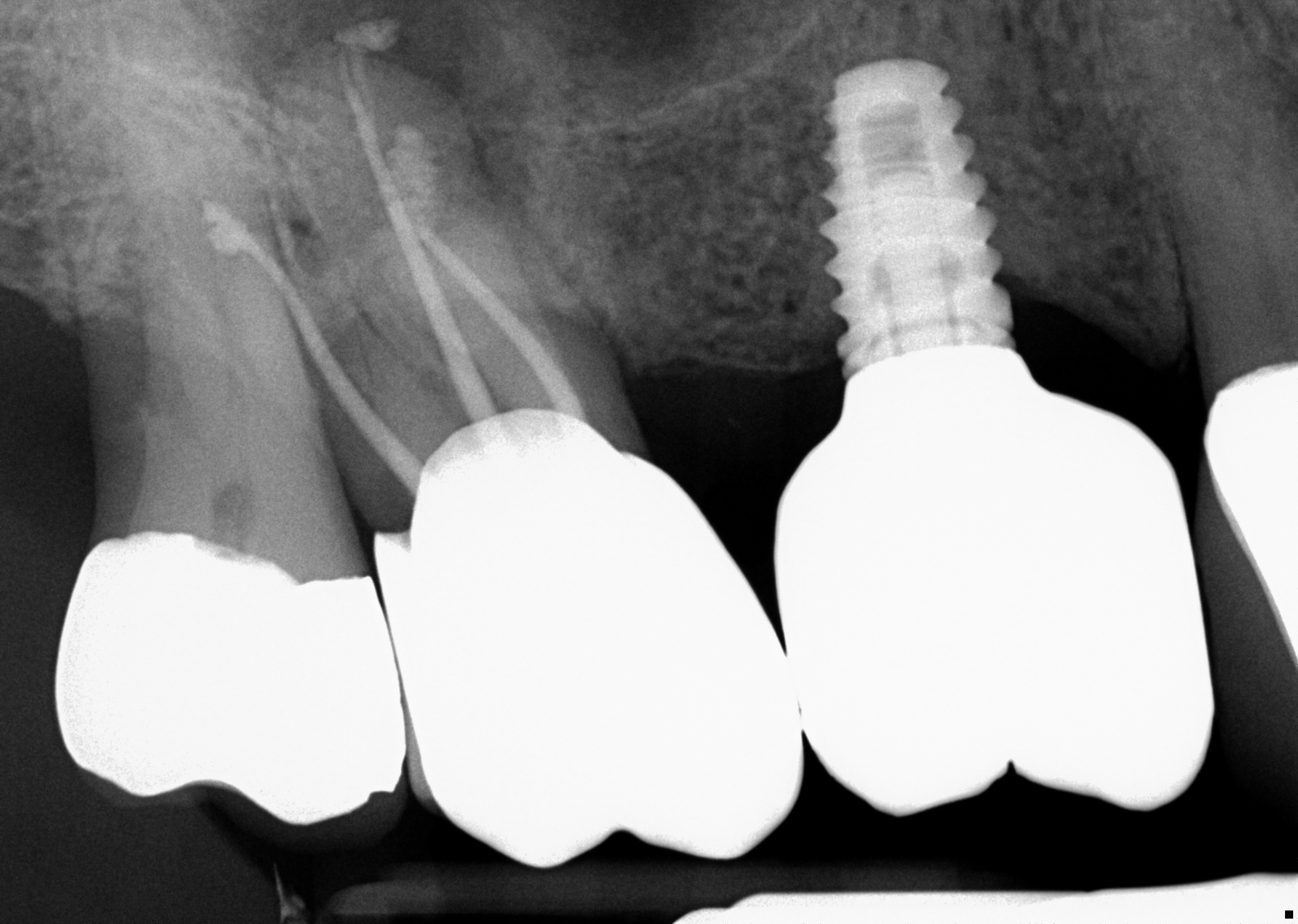pre-op radiograph