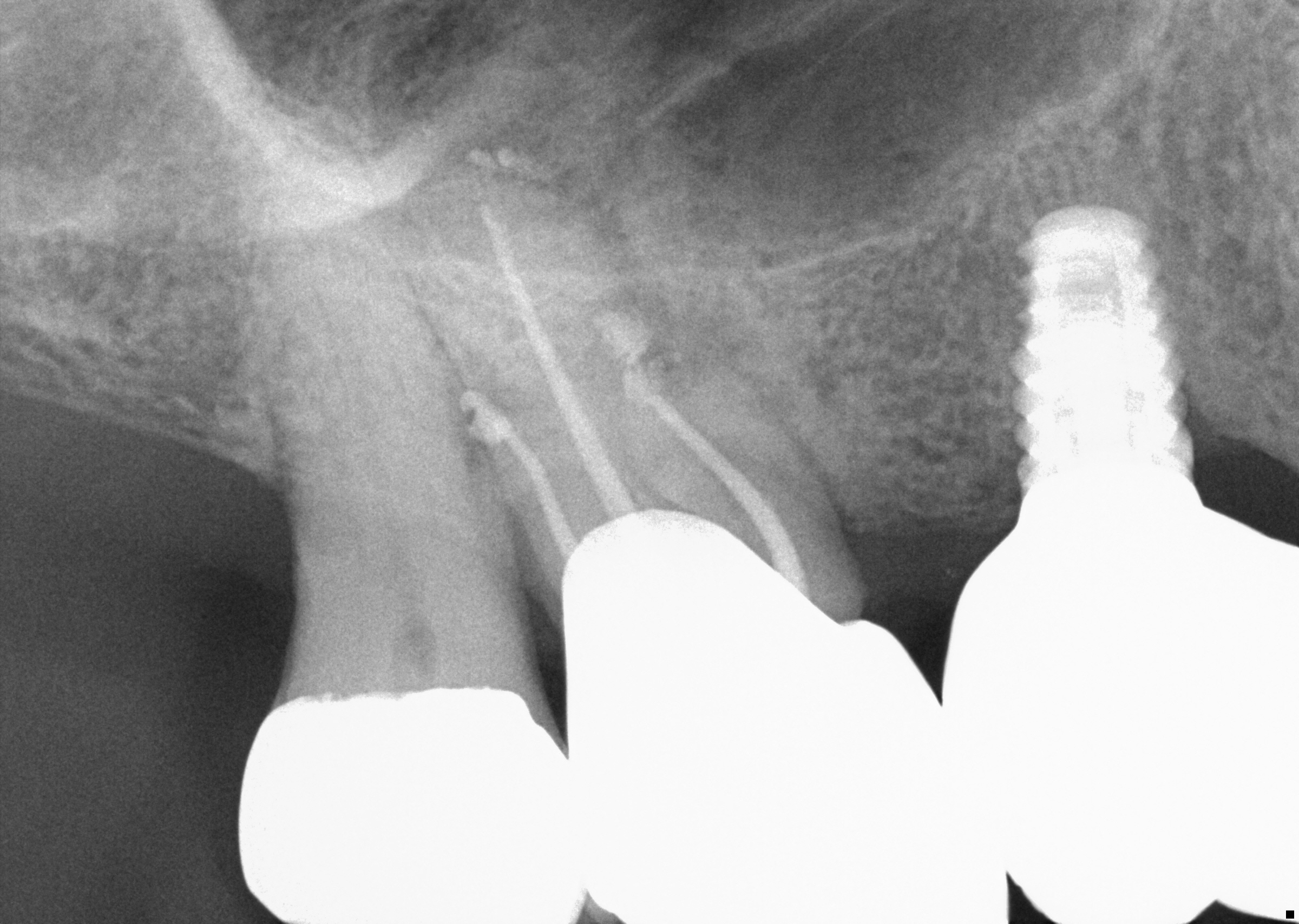 post-op radiograph