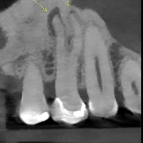 pre-op radiograph
