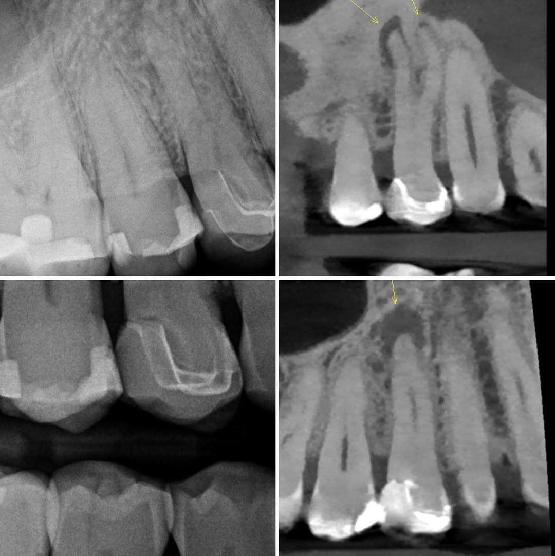 pre-op radiograph
